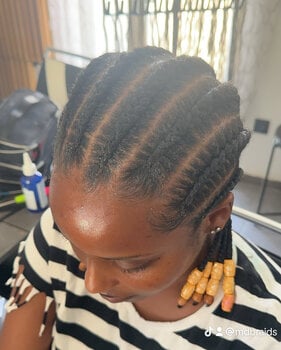 MDbraids
