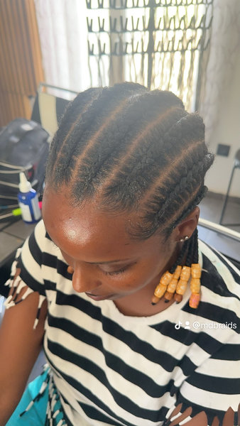 MDbraids