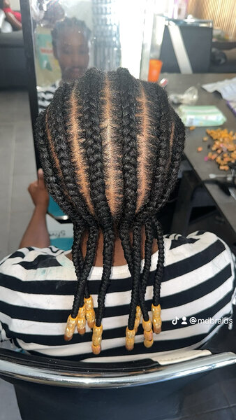 MDbraids