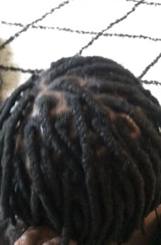 Braids