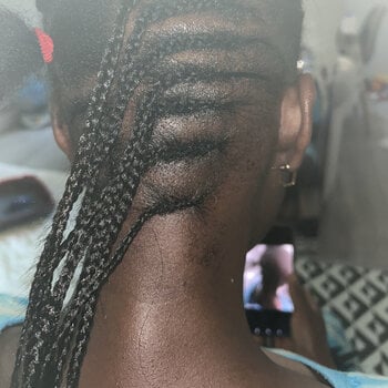 Cornrows
