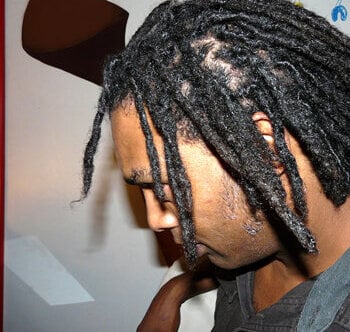 Dreadlocks de Karl