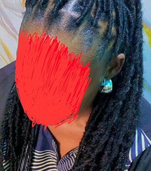 Dreadlocks