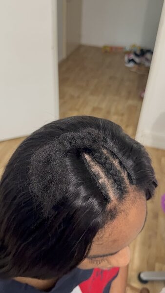 Knotless