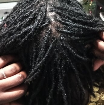 Reprise de locks