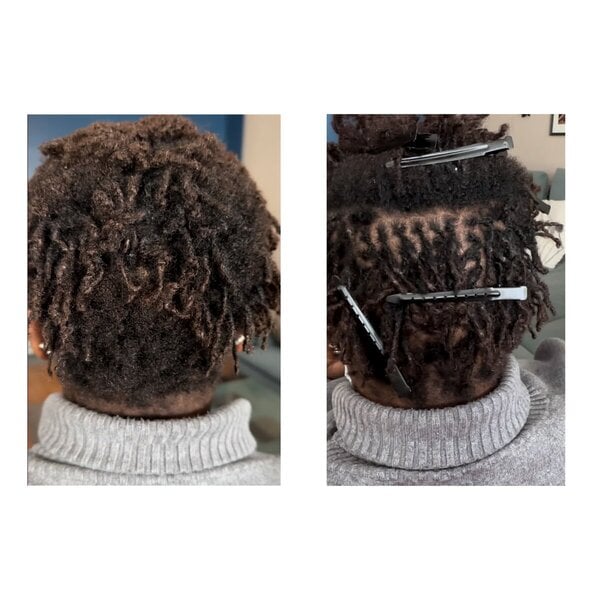 Resserrage / reprise microlocks