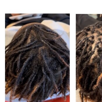 Resserrage / reprise microlocks